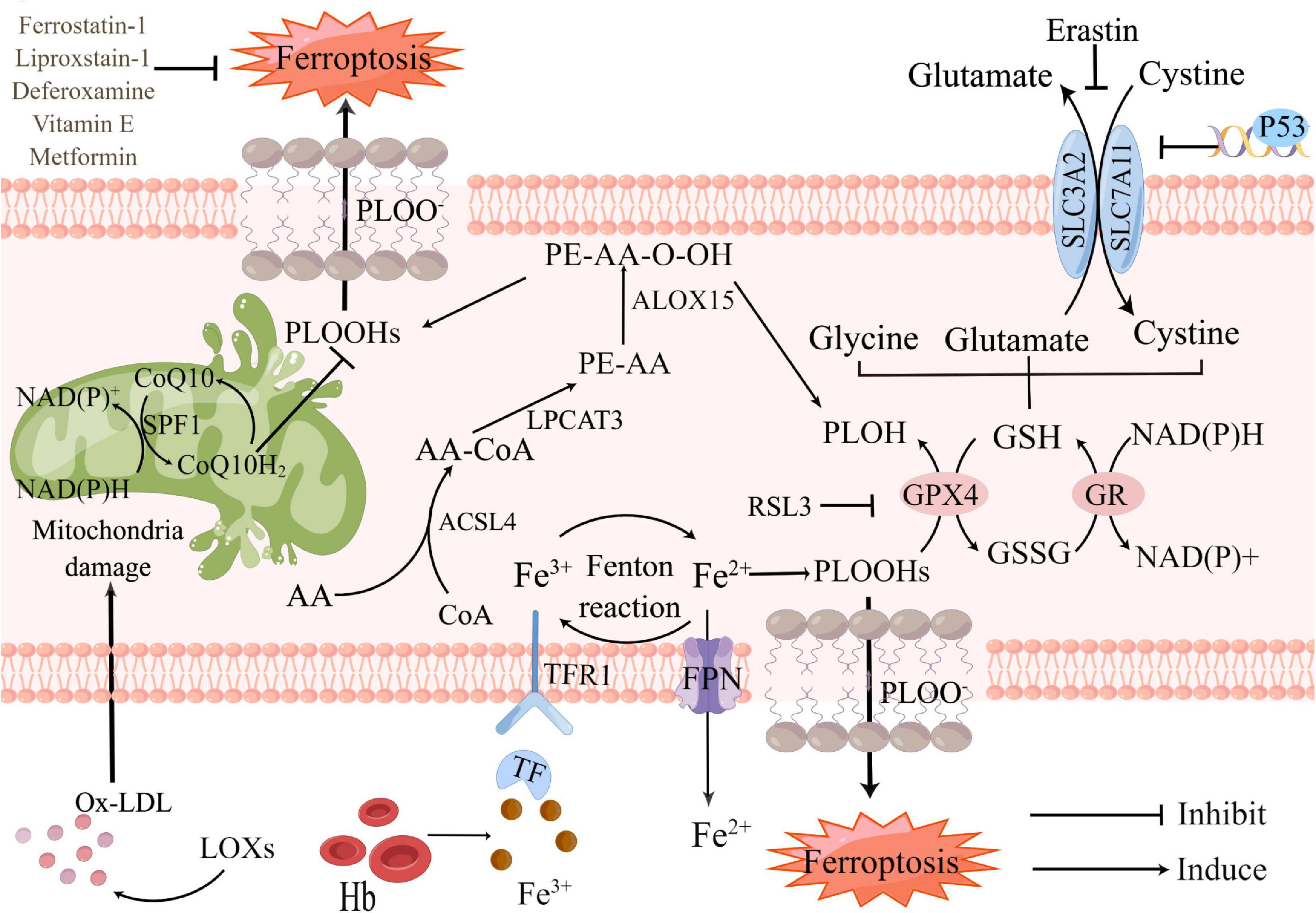 Ferroptosis: Underlying mechanism and the crosstalk with other modes of neuronal death after intracerebral hemorrhage